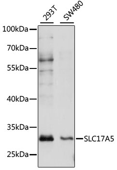 Western blot analysis of extracts of various cell lines using SLC17A5 Polyclonal Antibody at 1:1000 dilution.