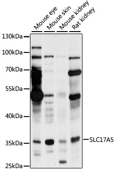 Western blot analysis of extracts of various cell lines using SLC17A5 Polyclonal Antibody at 1:1000 dilution.