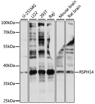 Western blot analysis of extracts of various cell lines using RSPH14 Polyclonal Antibody at 1:1000 dilution.