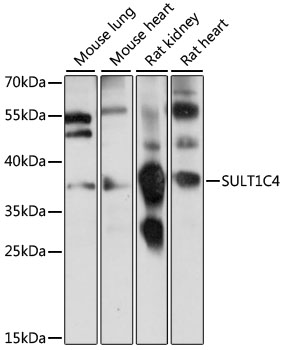 Western blot analysis of extracts of various cell lines using SULT1C4 Polyclonal Antibody at 1:1000 dilution.