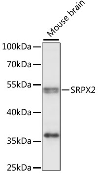 Western blot analysis of extracts of mouse brain using SRPX2 Polyclonal Antibody at 1:1000 dilution.