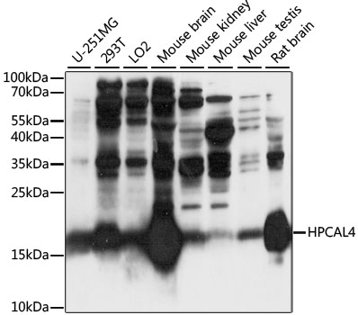 Western blot analysis of extracts of various cell lines using HPCAL4 Polyclonal Antibody at 1:1000 dilution.