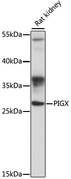 Western blot analysis of extracts of rat kidney using PIGX Polyclonal Antibody at 1:1000 dilution.