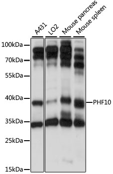 Western blot analysis of extracts of various cell lines using PHF10 Polyclonal Antibody at 1:1000 dilution.