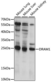 Western blot analysis of extracts of various cell lines using DRAM1 Polyclonal Antibody at 1:1000 dilution.