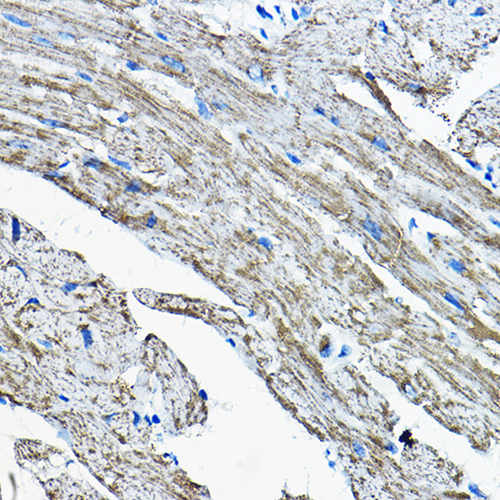 Immunohistochemistry of paraffin-embedded mouse heart using OGDHL Polyclonal Antibody at dilution of 1:200 (40x lens).Perform high pressure antigen retrieval with 10 mM citrate buffer pH 6.0 before commencing with IHC staining protocol.