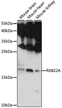 Western blot analysis of extracts of various cell lines using RAB22A Polyclonal Antibody at 1:1000 dilution.