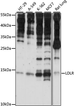 Western blot analysis of extracts of various cell lines using SNRNP25 Polyclonal Antibody at 1:1000 dilution.