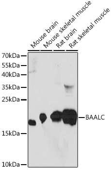 Western blot analysis of extracts of various cell lines using BAALC Polyclonal Antibody at1:1000 dilution.