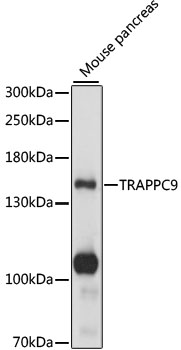 Western blot analysis of extracts of mouse pancreas using TRAPPC9 Polyclonal Antibody at 1:1000 dilution.