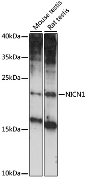 Western blot analysis of extracts of various cell lines using NICN1 Polyclonal Antibody at 1:1000 dilution.