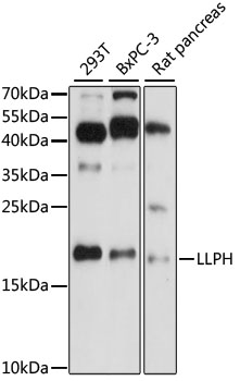 Western blot analysis of extracts of various cell lines using LLPH Polyclonal Antibody at 1:1000 dilution.