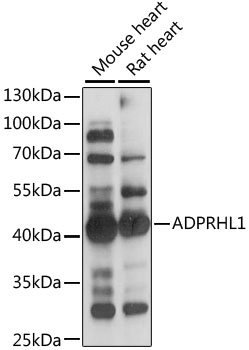 Western blot analysis of extracts of various cell lines using ADPRHL1 Polyclonal Antibody at 1:1000 dilution.