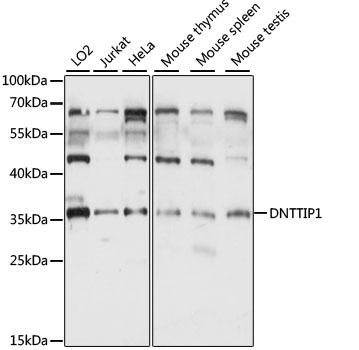 Western blot analysis of extracts of various cell lines using DNTTIP1 Polyclonal Antibody at 1:1000 dilution.