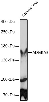 Western blot analysis of extracts of Mouse liver using ADGRA3 Polyclonal Antibody at1:1000 dilution.