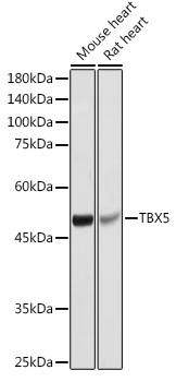 Western blot analysis of extracts of various cell lines using TBX5 Polyclonal Antibody at 1:1000 dilution.