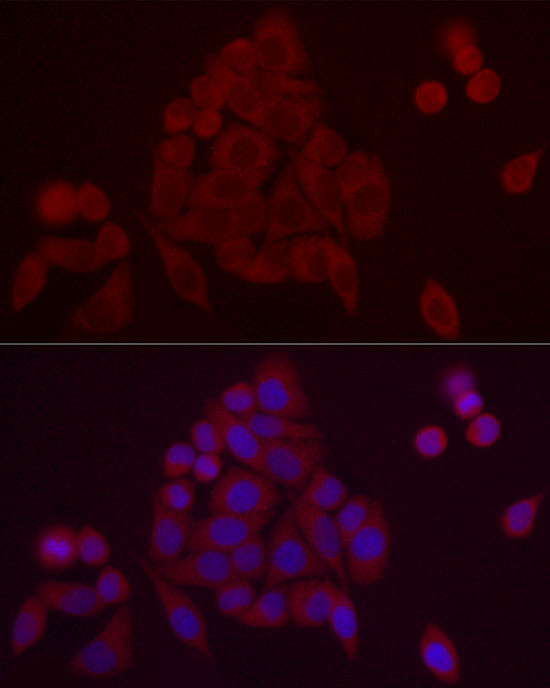 Immunofluorescence analysis of HeLa cells using PDE10A Polyclonal Antibody at dilution of 1:20 (40x lens). Blue: DAPI for nuclear staining.