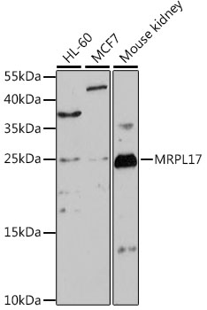 Western blot analysis of extracts of various cell lines using MRPL17 Polyclonal Antibody at 1:1000 dilution.