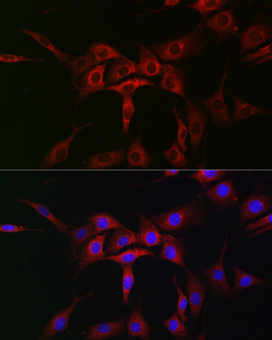 Immunofluorescence analysis of NIH/3T3 cells using ATG12 Polyclonal Antibody at dilution of 1:50 (40x lens). Blue: DAPI for nuclear staining.