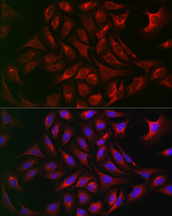 Immunofluorescence analysis of U2OS cells using ATG12 Polyclonal Antibody at dilution of 1:50 (40x lens). Blue: DAPI for nuclear staining.