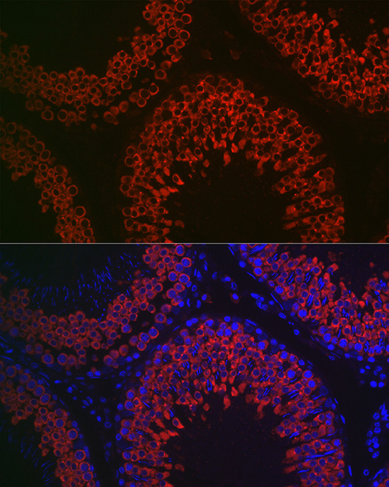 Immunofluorescence analysis of rat testis using DDX4 Polyclonal Antibody at dilution of 1:100 (40x lens). Blue: DAPI for nuclear staining.