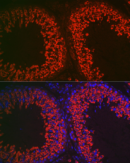 Immunofluorescence analysis of rat testis cells using DDX4 Polyclonal Antibody at dilution of 1:100 (40x lens). Blue: DAPI for nuclear staining.