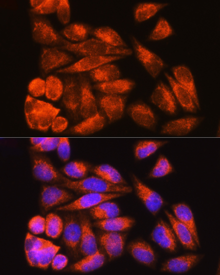 Immunofluorescence analysis of HeLa cells using ODF2 Polyclonal Antibody at dilution of 1:100. Blue: DAPI for nuclear staining.
