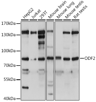 Western blot analysis of extracts of various cell lines using ODF2 Polyclonal Antibody at 1:500 dilution.