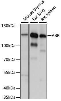 Western blot analysis of extracts of various cell lines using ABR Polyclonal Antibody at 1:1000 dilution.