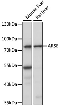 Western blot analysis of extracts of various cell lines using ARSE Polyclonal Antibody at 1:1000 dilution.