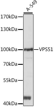 Western blot analysis of extracts of A-549 cells using VPS51 Polyclonal Antibody at 1:1000 dilution.