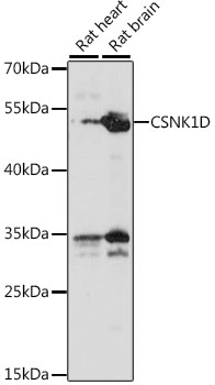 Western blot analysis of extracts of various cell lines using CSNK1D Polyclonal Antibody at 1:1000 dilution.