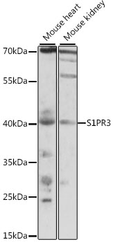 Western blot analysis of extracts of various cell lines using S1PR3 Polyclonal Antibody at 1:1000 dilution.