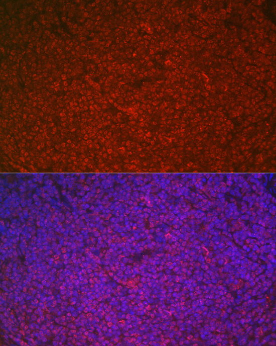 Immunofluorescence analysis of rat spleen cells using ETS1 Polyclonal Antibody at dilution of 1:100 (40x lens). Blue: DAPI for nuclear staining.