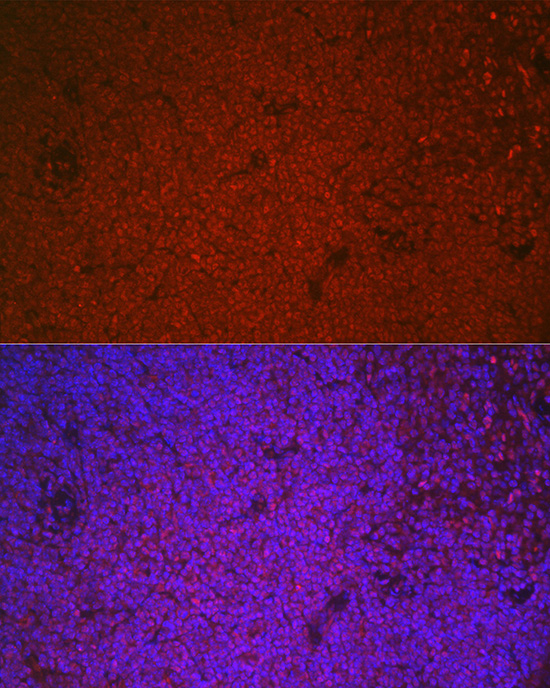 Immunofluorescence analysis of mouse spleen cells using ETS1 Polyclonal Antibody at dilution of 1:100 (40x lens). Blue: DAPI for nuclear staining.