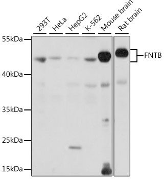 Western blot analysis of extracts of various cell lines using FNTB Polyclonal Antibody at 1:1000 dilution.