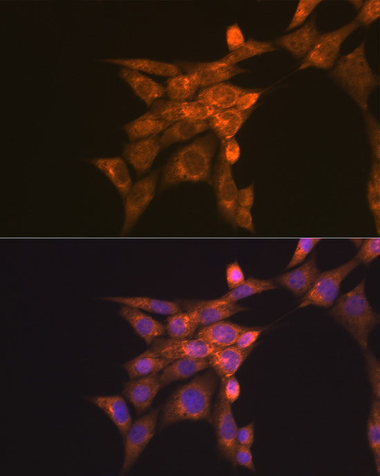 Immunofluorescence analysis of NIH-3T3 cells using Folate Binding Protein Polyclonal Antibody at dilution of 1:100 (40x lens). Blue: DAPI for nuclear staining.