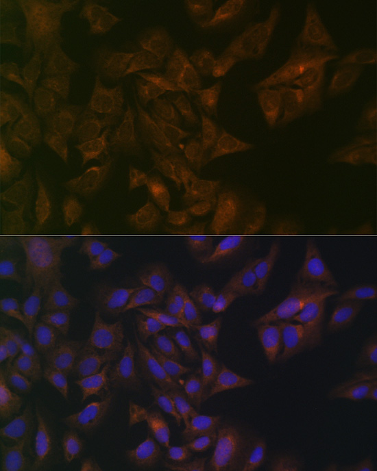 Immunofluorescence analysis of U2OS cells using Folate Binding Protein Polyclonal Antibody at dilution of 1:100 (40x lens). Blue: DAPI for nuclear staining.