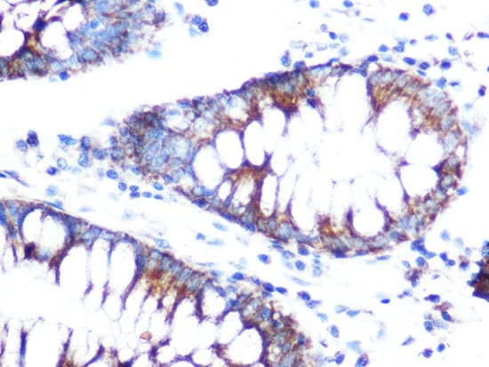 Immunohistochemistry of paraffin-embedded human colon using Folate Binding Protein Polyclonal Antibody at dilution of 1:100 (40x lens).Perform microwave antigen retrieval with 10 mM Tris/EDTA buffer pH 9.0 before commencing with IHC staining protocol.