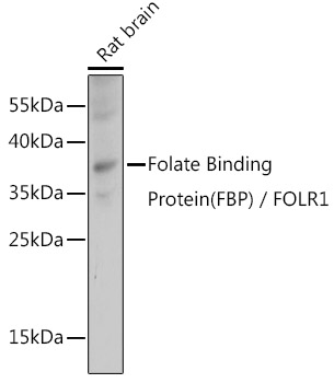 Western blot analysis of extracts of Rat brain using Folate Binding Proteinat 1:1000 dilution.