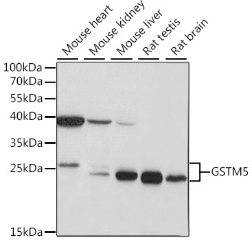 Western blot analysis of extracts of various cell lines using GSTM5 Polyclonal Antibody at 1:1000 dilution.