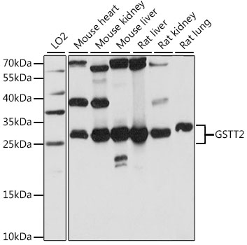 Western blot analysis of extracts of various cell lines using GSTT2 Polyclonal Antibody at 1:1000 dilution.