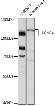 Western blot analysis of extracts of various cell lines using KCNC4 Polyclonal Antibody at 1:1000 dilution.