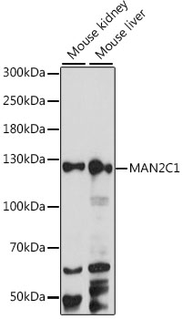 Western blot analysis of extracts of various cell lines using MAN2C1 Polyclonal Antibody at 1:1000 dilution.