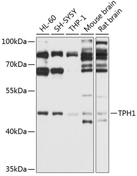 Western blot analysis of extracts of various cell lines using TPH1 Polyclonal Antibody at 1:1000 dilution.