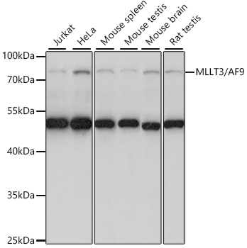 Western blot analysis of extracts of various cell lines using MLLT3/AF9 Polyclonal Antibody at 1:1000 dilution.