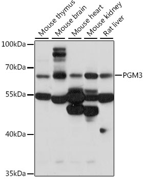 Western blot analysis of extracts of various cell lines using PGM3 Polyclonal Antibody at 1:1000 dilution.