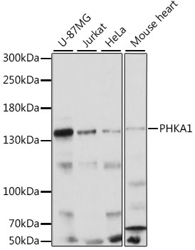 Western blot analysis of extracts of various cell lines using PHKA1 Polyclonal Antibody at 1:1000 dilution.