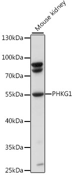 Western blot analysis of extracts of mouse kidney using PHKG1 Polyclonal Antibody at 1:1000 dilution.