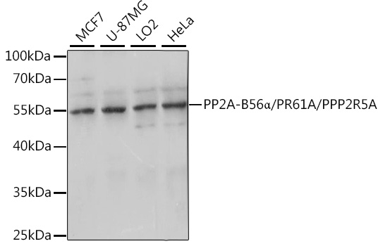 Western blot analysis of extracts of various cell lines using PP2A-B56α/PR61A/PP2A-B56α/PR61A/PPP2R5A Polyclonal Antibody at 1:1000 dilution.